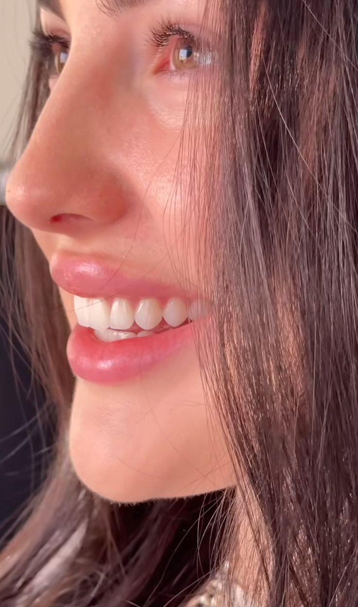 صورة الموضوع